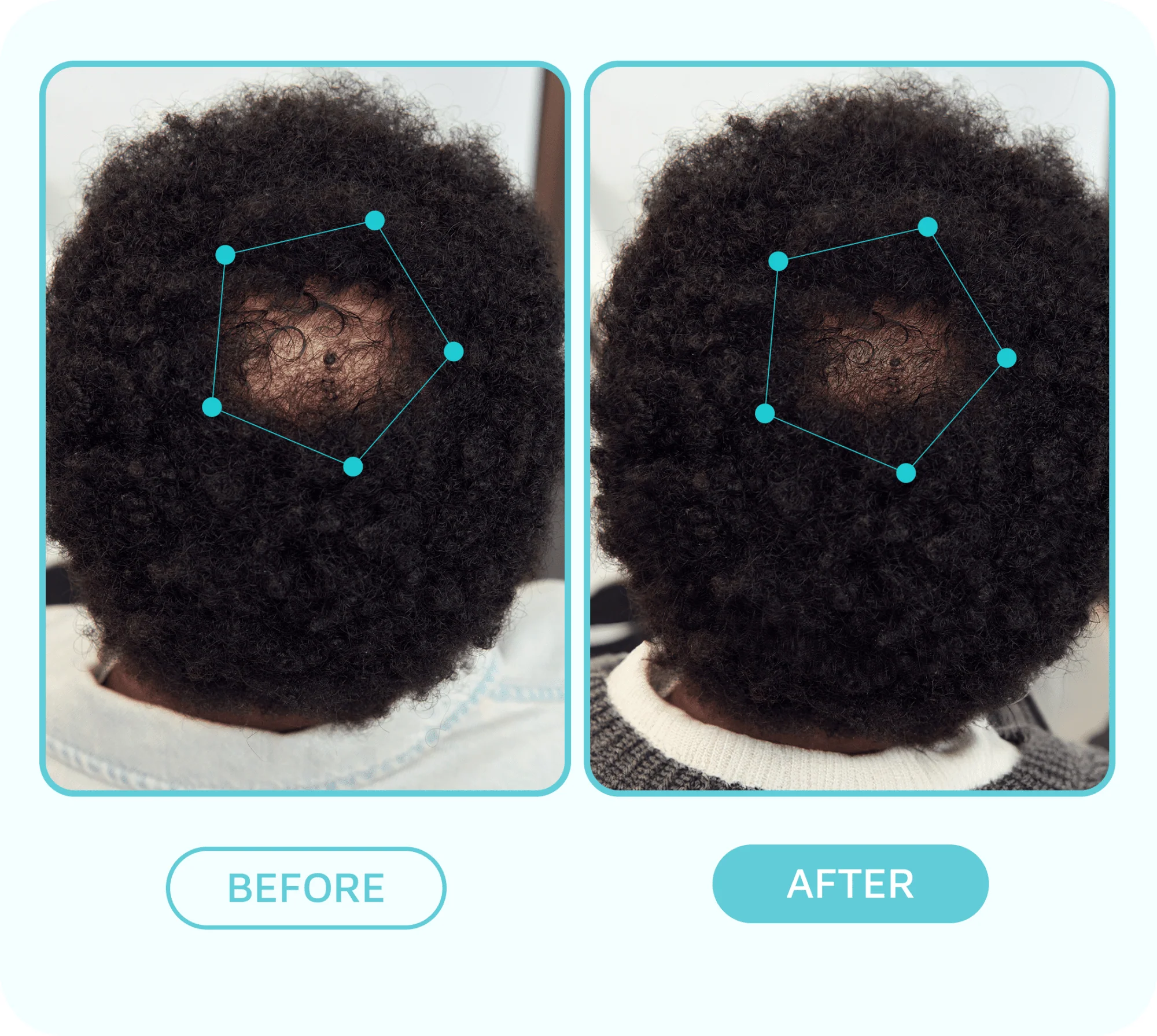Healthy Hair Fixation Trio | Spot Fixer Growth Serum - Image 5